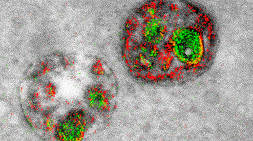電子顯微鏡首次拍攝下細(xì)胞多色彩照片